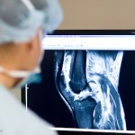 Permalink to BC Lions Defensive Back Stanley Franks grateful to Royal Columbian Hospital medical teams for saving his leg RCH Orthopaedic Surgeon Dr. Darius Viskontas views image of Stanley Franks’s left leg, prior to surgery.